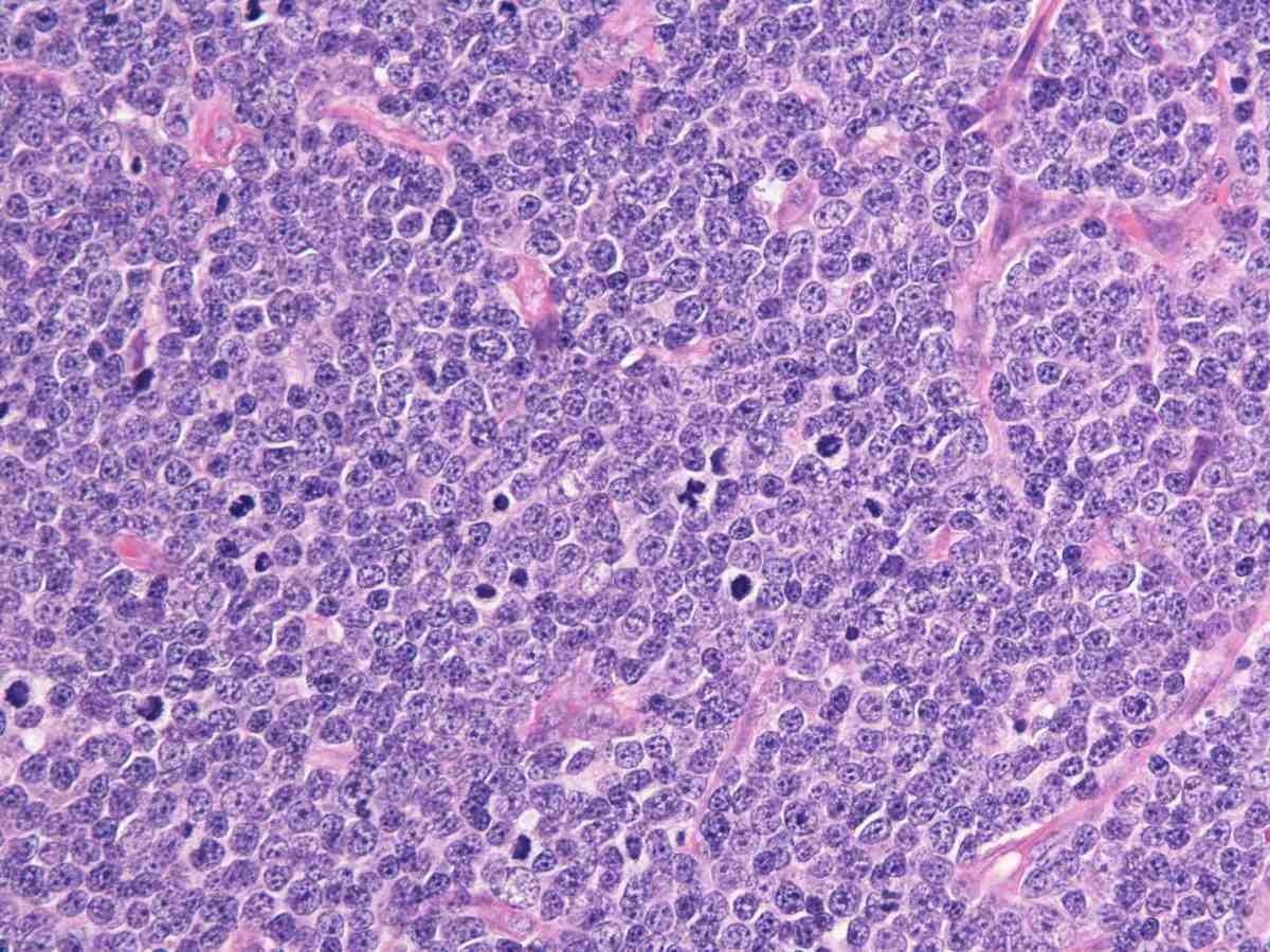 Lymph node 2012 40X HE